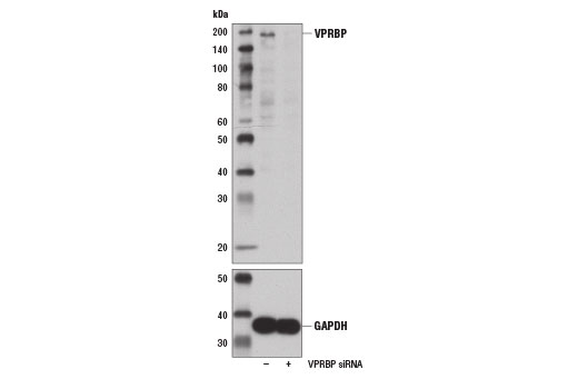Western Blotting Image 2: VPRBP Antibody