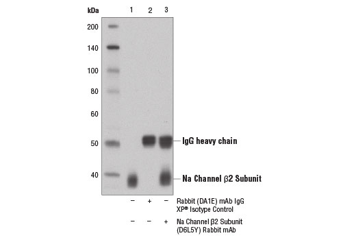 Immunoprecipitation Image 1: Na Channel β2 Subunit (D6L5Y) Rabbit mAb