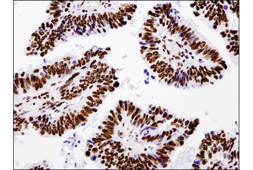 Immunohistochemistry Image 3: Acetyl-Histone H3 (Lys18) (D8Z5H) Rabbit mAb