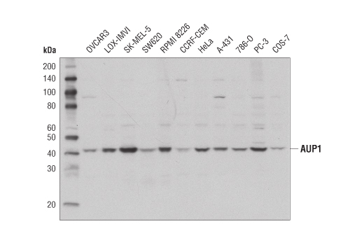 Western Blotting Image 1: AUP1 Antibody