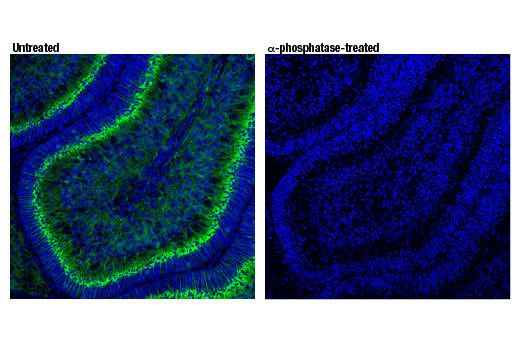 Immunofluorescence Image 1: Phospho-Doublecortin (Ser334) (D11B10) Rabbit mAb
