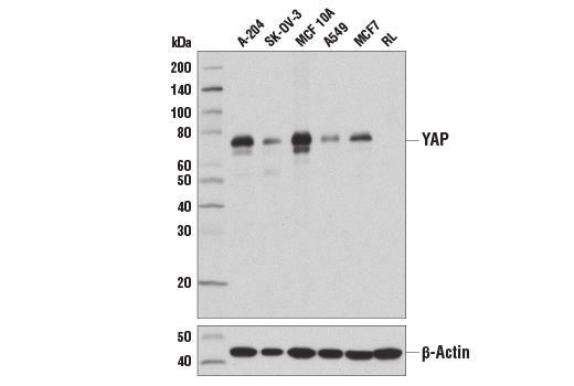  Image 8: PhosphoPlus® YAP (Ser109) Antibody Duet