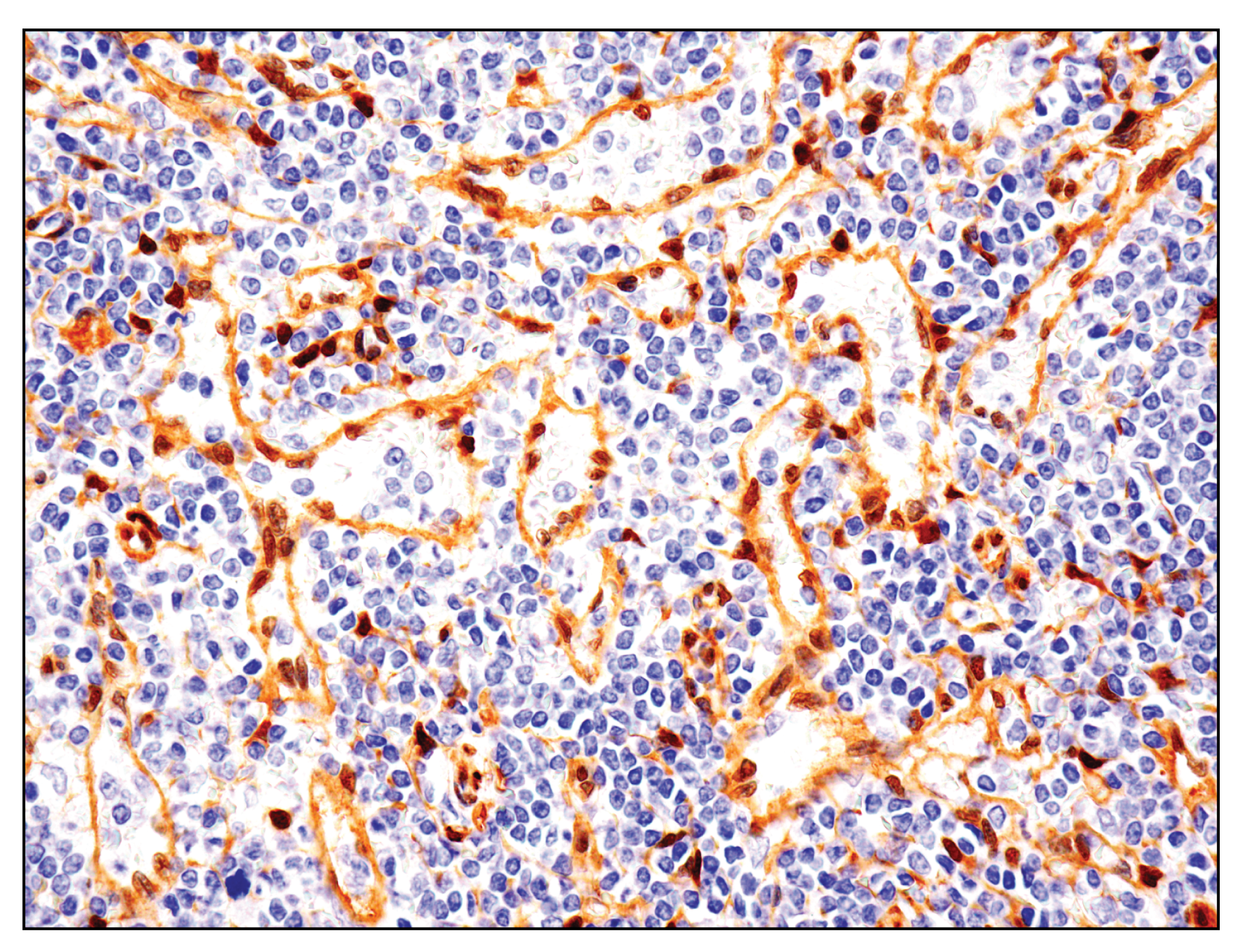  Image 12: PhosphoPlus® YAP (Ser109) Antibody Duet