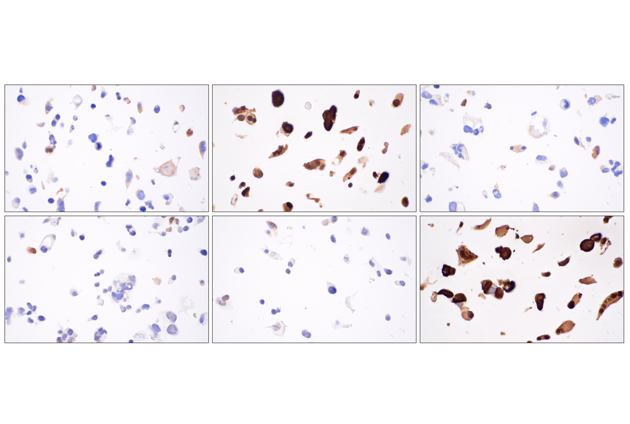  Image 75: Small Cell Lung Cancer Biomarker Antibody Sampler Kit