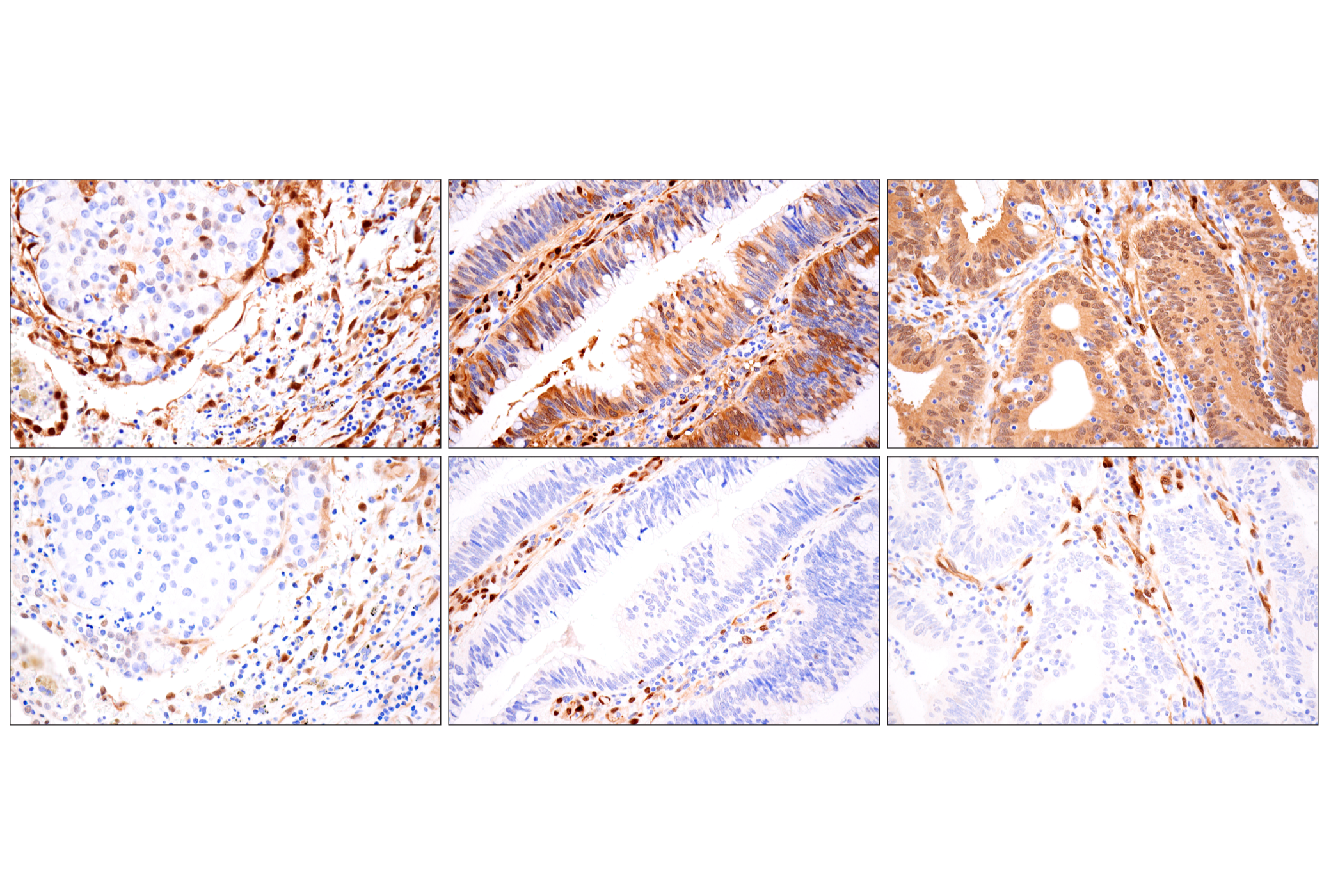  Image 67: Small Cell Lung Cancer Biomarker Antibody Sampler Kit