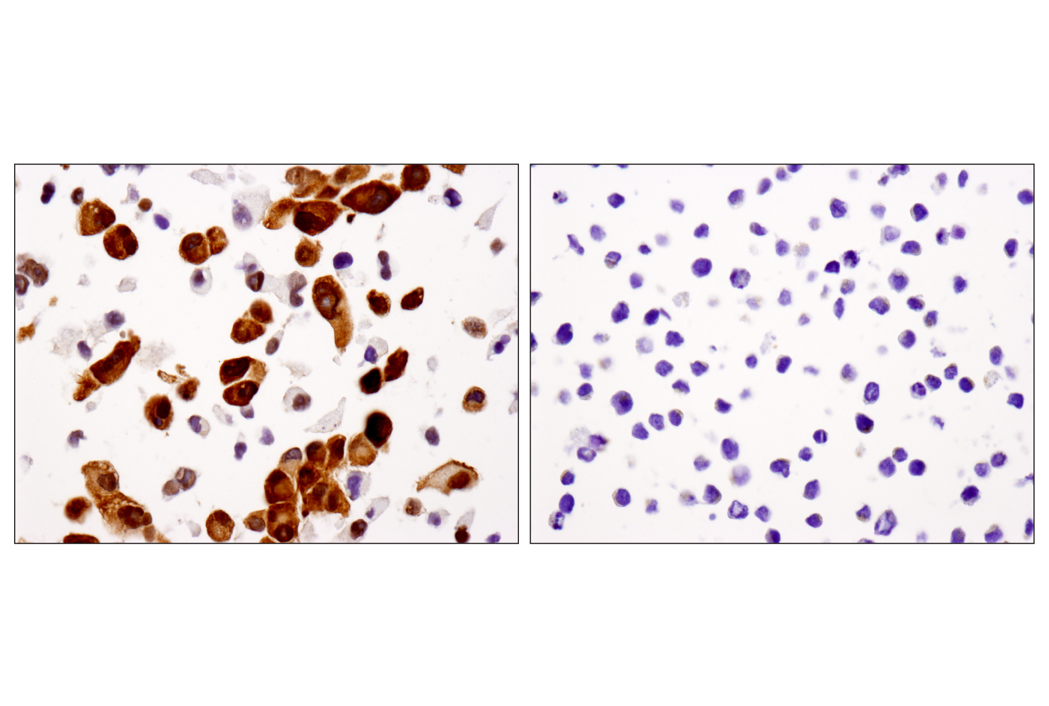  Image 80: Small Cell Lung Cancer Biomarker Antibody Sampler Kit