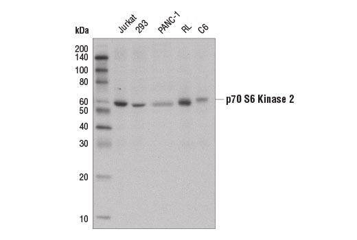 Western Blotting Image 1: p70 S6 Kinase 2 Antibody