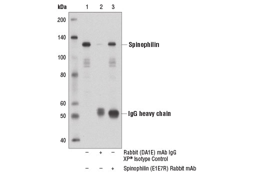 Immunoprecipitation Image 1: Spinophilin (E1E7R) Rabbit mAb