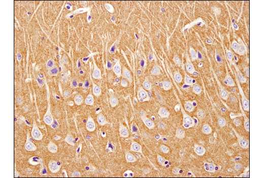  Image 13: Neuronal Scaffold Proteins Antibody Sampler Kit