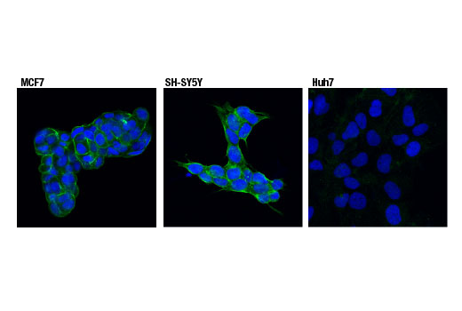 Immunofluorescence Image 1: Spinophilin (E1E7R) Rabbit mAb
