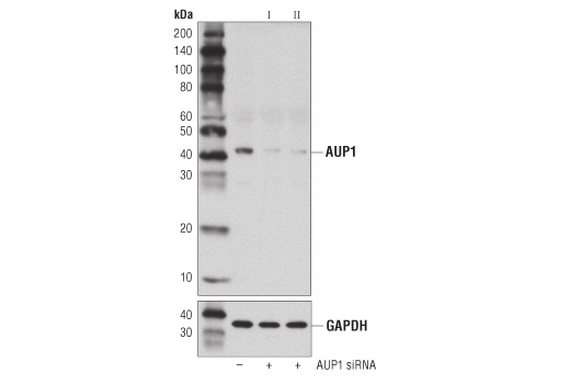  Image 1: SignalSilence® AUP1 siRNA II