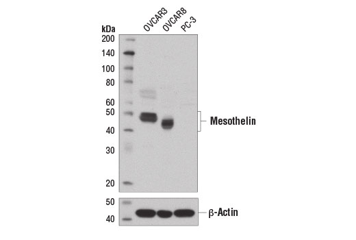 Western Blotting Image 1: Mesothelin Antibody