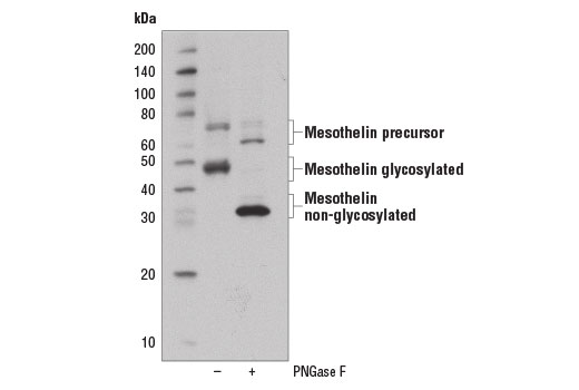 Western Blotting Image 2: Mesothelin Antibody