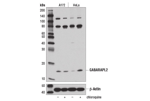  Image 19: Autophagy Atg8 Family Antibody Sampler Kit