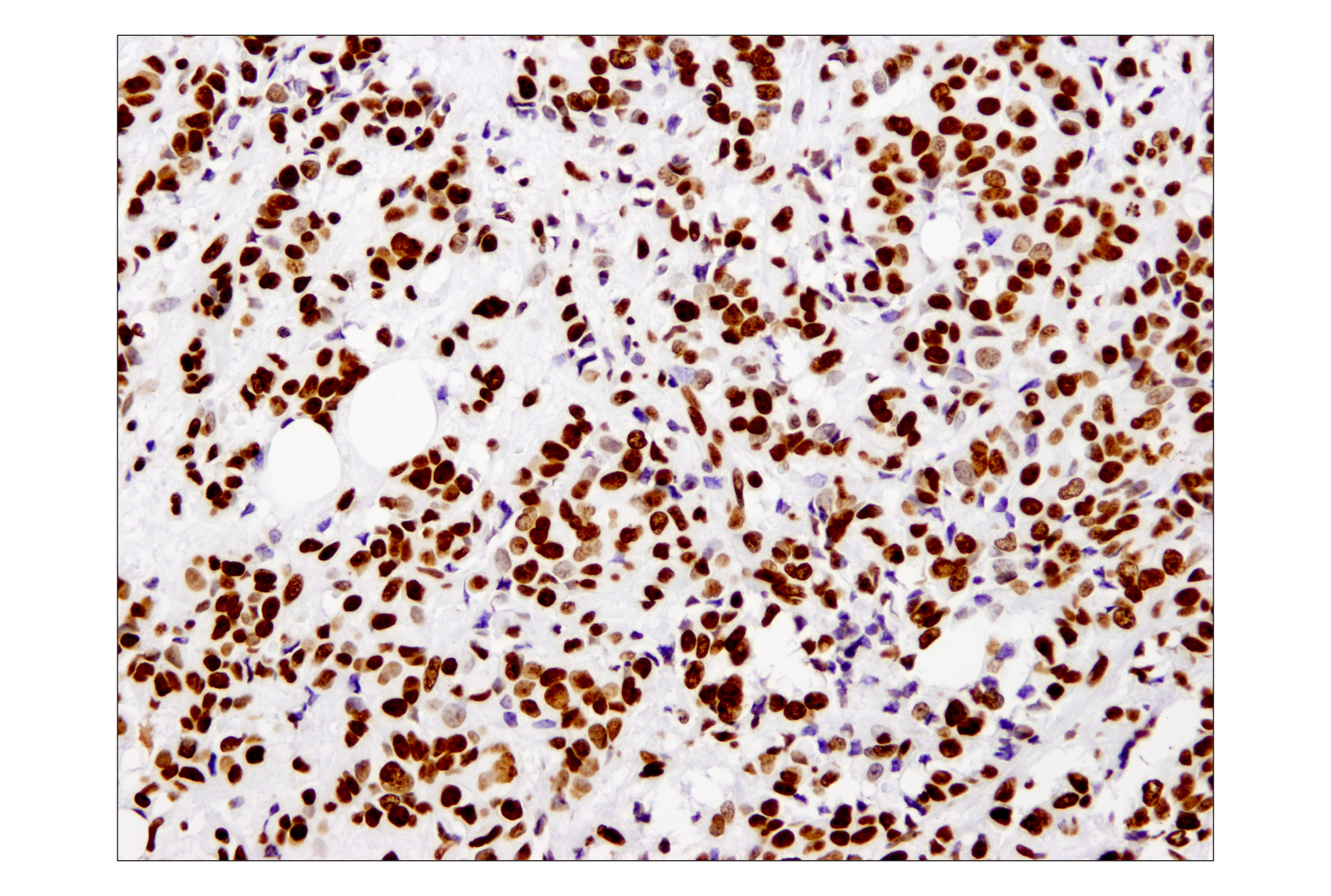 Immunohistochemistry Image 1: Histone H3 (1B1B2) Mouse mAb