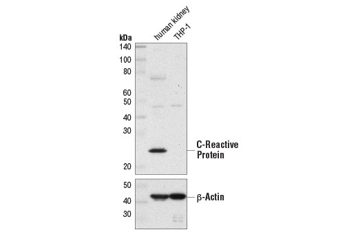 Western Blotting Image 1: C-Reactive Protein (D1N1U) Rabbit mAb