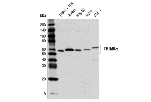 Western Blotting Image 1: TRIM5α (D6Z8L) Rabbit mAb