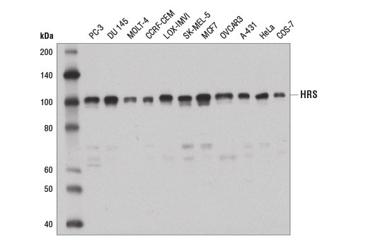 Western Blotting Image 1: HRS Antibody