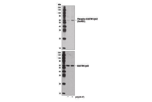 Western Blotting Image 1: Phospho-SQSTM1/p62 (Ser403) Antibody
