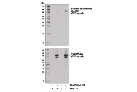 Western Blotting Image 2: Phospho-SQSTM1/p62 (Ser403) Antibody