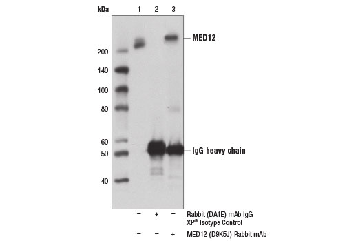 Immunoprecipitation Image 1: MED12 (D9K5J) Rabbit mAb