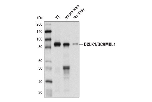 Western Blotting Image 1: DCLK1/DCAMKL1 Antibody