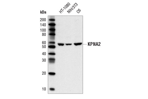 Western Blotting Image 1: KPNA2 Antibody