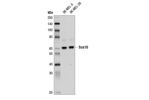 Western Blotting Image 1: Sox10 Antibody