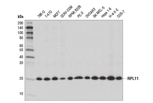 Western Blotting Image 1: RPL11 Antibody