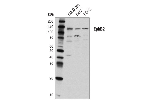 Western Blotting Image 1: EphB2 Antibody