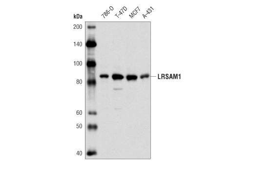 Western Blotting Image 1: LRSAM1 Antibody