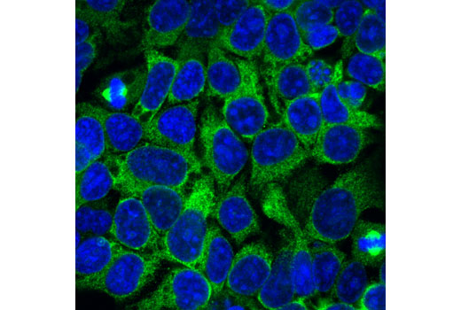 Immunofluorescence Image 1: Eg5 (E1L3W) Rabbit mAb