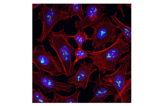 Immunofluorescence Image 1: Fibrillarin (C13C3) Rabbit mAb (Alexa Fluor® 488 Conjugate)