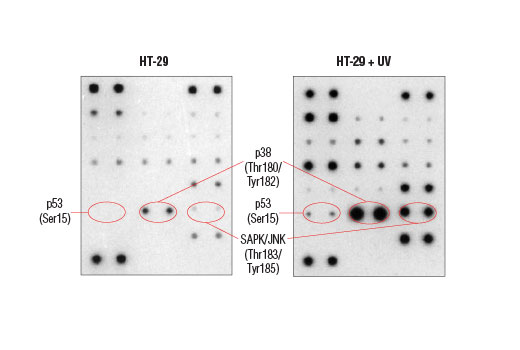  Image 3: PathScan® Intracellular Signaling Membrane Array Kit (Chemiluminescent Readout)