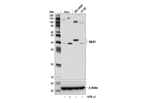  Image 3: OAS/RNase L Pathway Antibody Sampler Kit
