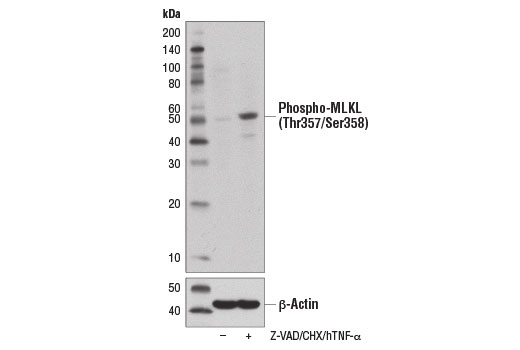 Western Blotting Image 1: Phospho-MLKL (Thr357/Ser358) Antibody