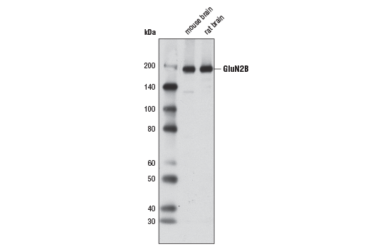 Western Blotting Image 1: NMDA Receptor 2B (GluN2B) (D8E10) Rabbit mAb