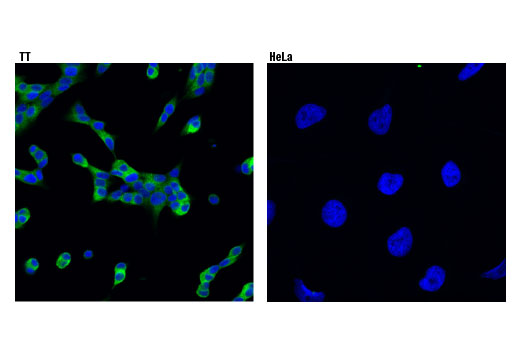 Immunofluorescence Image 1: Ret (E1N8X) XP® Rabbit mAb