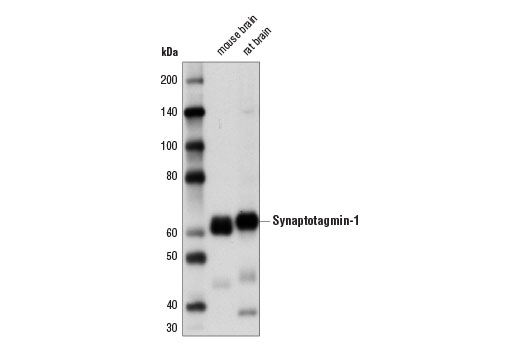  Image 6: Presynaptic Vesicle Cycle Antibody Sampler Kit