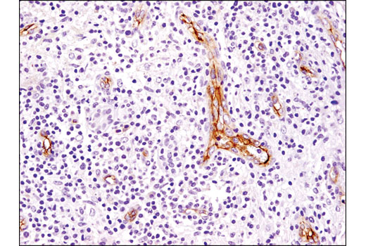 Immunohistochemistry Image 1: CD105/Endoglin (3A9) Mouse mAb