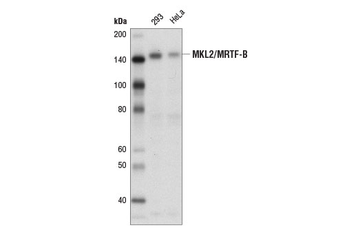 Western Blotting Image 1: MKL2/MRTF-B Antibody