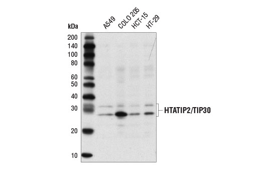 Western Blotting Image 1: HTATIP2/TIP30 Antibody