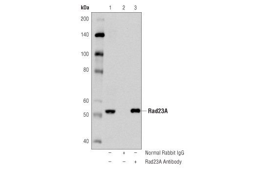 Immunoprecipitation Image 1: Rad23A Antibody