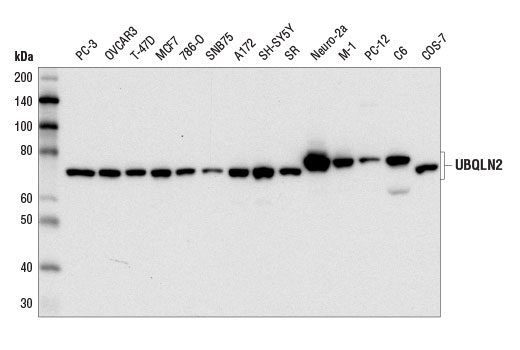 Western Blotting Image 1: UBQLN2 Antibody