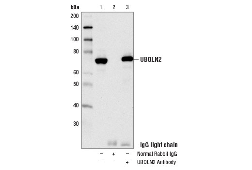 Immunoprecipitation Image 1: UBQLN2 Antibody