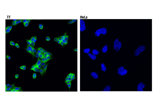 Immunofluorescence Image 1: Ret (D3D8R) Rabbit mAb
