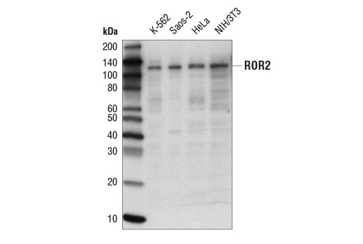 Western Blotting Image 1: ROR2 (R518) Antibody