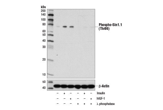  Image 2: PhosphoPlus® Sin1 (Thr86) Antibody Duet