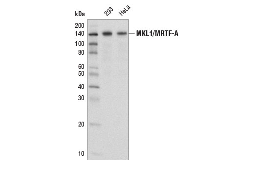 Western Blotting Image 1: MKL1/MRTF-A Antibody