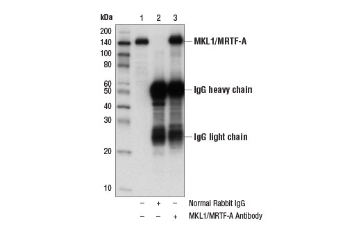 Immunoprecipitation Image 1: MKL1/MRTF-A Antibody